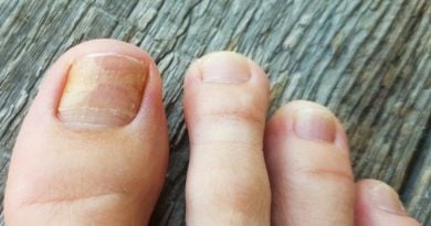 Гель NormaDerm от грибка стоп и ногтей. Официальный сайт, реальные отзывы